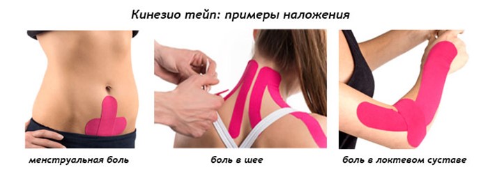 Тейпирование голеностопа: тейпы для кинезотейпирования